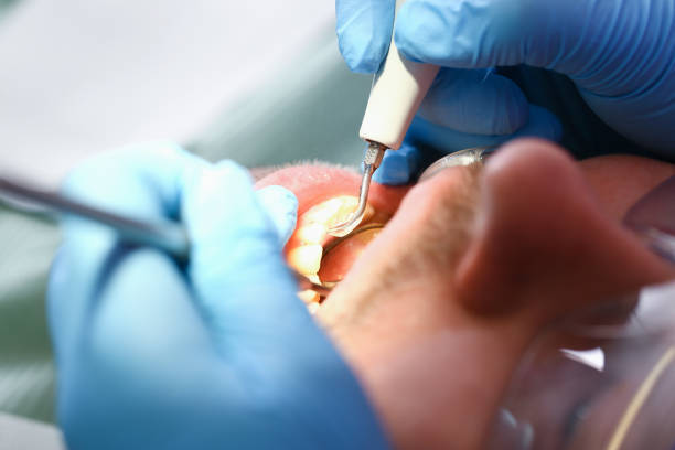 Best Cosmetic Emergency Dentistry in Palm Springs, FL